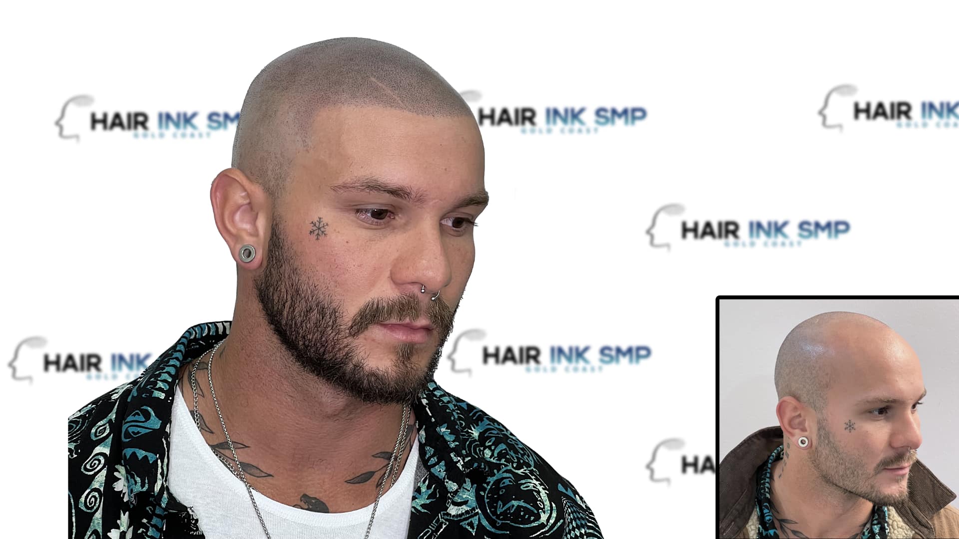 What are the characteristics of the ink used in hair micropigmentation? -  Osman YAMAN